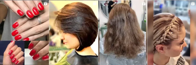 بهترین دکتر تزریق فیلر 2 نمونه کاز بهترین سالن زیبایی آپامه در پاسداران